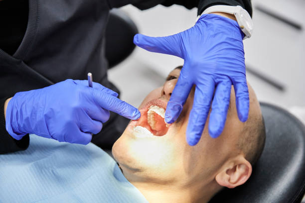 Best Emergency Dental Care for Broken or Chipped Teeth in Albion, PA